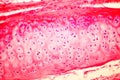 Hyaline cartilage of human trachea