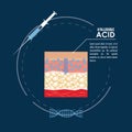 Hyaluronic acid filler injection infographic Royalty Free Stock Photo