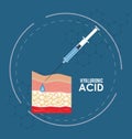 Hyaluronic acid filler injection infographic Royalty Free Stock Photo