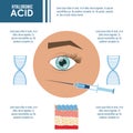 Hyaluronic acid filler injection infographic Royalty Free Stock Photo