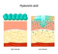 Hyaluronic acid. Hyaluronic acid in skin-care products.
