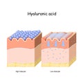 Hyaluronic acid in skin-care products. Low molecule and High molecular
