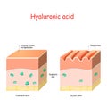 Hyaluronic acid in younger and older skin