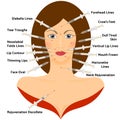 Hyaluronic Asid Infographic. Face Plastic Surgery Royalty Free Stock Photo