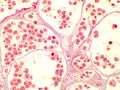 Hydatid cyst under the microscope 100x. Echinococcus granulosus. Dog tapeworm parasite
