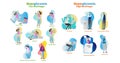 Hyperglycemia and hypoglycemia vector illustration collection set. Isolated symptom and signs as warning to disease and disorder. Royalty Free Stock Photo