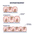 Hypertrophy, hyperplasia or healthy muscular cells comparison outline diagram