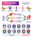 Hypoglycemia vector illustration. Labeled low sugar level medical scheme. Royalty Free Stock Photo