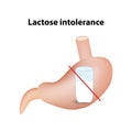 Hypolactasia. Lactose intolerance. Stomach. A glass of milk. Infographics. Vector illustration on isolated background