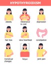 Hypothyroidism medical info-graphic vector. Endocrinology illustration. Symptoms of sick human thyroid gland are shown Royalty Free Stock Photo