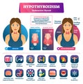 Hypothyroidism vector illustration. Labeled underactive thyroid explanation