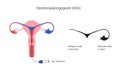 Hysterosalpingogram clinical test of the uterine tubes blockage.