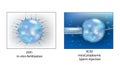ICSI and IVF in vitro fertilization. Royalty Free Stock Photo