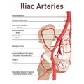 Iliac arteries. The main veins and arteries of the lower body, blood vessels Royalty Free Stock Photo