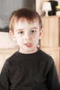 Ill boy with flu and green rhinitis Royalty Free Stock Photo