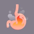 Illustration from acid reflux or heartburn