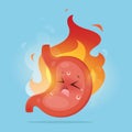 Illustration from Acid reflux or Heartburn