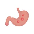 Illustration from acid reflux or heartburn Royalty Free Stock Photo