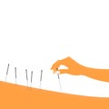 Illustration of acupuncture. hand and needle for acupuncture