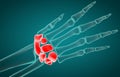 3D illustration of Carpal, medical concep