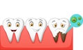 Cartoon normal and unhealthy tooth