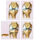 Clavicula Illustration Front and side view of the human clavicle, located in the upper anterior part of the thorax.