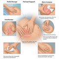 Illustration demonstrating various techniques for providing perineal support during childbirth. It Royalty Free Stock Photo