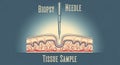 Biopsy needle inserted into tissue sample with cross-section of skin layers illustration Royalty Free Stock Photo