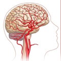 Illustration and descriptive scheme of the aneurysm in the human brain.