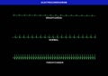 Illustration of different heart rate on electrocardiogram Royalty Free Stock Photo