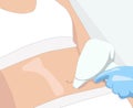 Illustration.Elos epilation, hair removal procedure on a womanâs body. Beautician doing laser rejuvenation in a beauty salon.