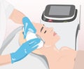 Illustration. Epilation hair removal procedure on a womanâs face.