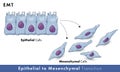 Epithelial to mesenchymal transition Royalty Free Stock Photo