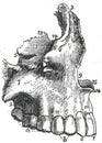 Illustration of facial bones, teeth and nose from atlas of human anatomy in late 19th, early 20th