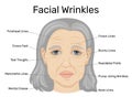 Illustration of facial wrinkles Royalty Free Stock Photo