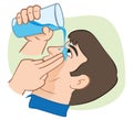 Illustration First Aid flush eyes with water