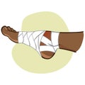 Illustration of first aid person afro descent, bandaged foot, side view