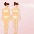 Illustration of anorexia phases Royalty Free Stock Photo