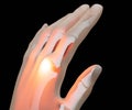 Human gout arthritis, Joint pain. finger pain 3d rendering