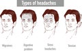Illustration about headaches 4 type on different area of patient Royalty Free Stock Photo
