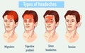 Illustration about headaches 4 type on different area of patient Royalty Free Stock Photo