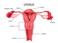 Healthcare and Medical education drawing chart of Human Female Uterus part of Reproductive System for Science Biology Royalty Free Stock Photo