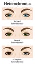 Illustration of Heterochromia iridum Royalty Free Stock Photo