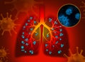 Illustration of human lungs affected with disease on background