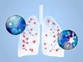 Illustration of human lungs affected with disease on blue background