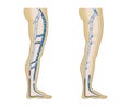 Illustration leg veins Royalty Free Stock Photo
