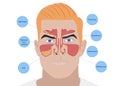 Illustration of man with healthy and inflammed paranasal sinuses on white background