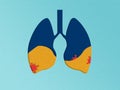 Illustration of papercut lungs with virus. Pneumonia concept. Covid-19 coronavirus pandemic problem