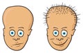 Illustration - patient with a bald head and hair