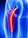 Illustration of sciatic nerve pain Royalty Free Stock Photo